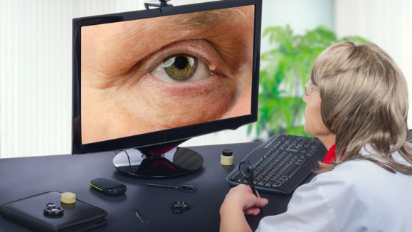 Telemedicine eye doctor observes eyelid cyst on computer