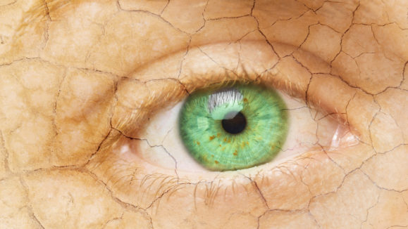 Cracked Skin. Closeup of a female eye with cracked skin. Aging process or pain and loneliness conceptual image.
