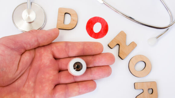 Donation,Of,Eye,Or,Cornea,Transplant,(graft,,Keratoplasty),In,Donor