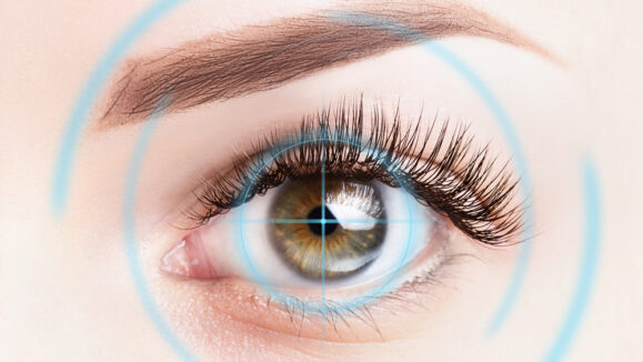 Refractive,Surgery,,Eye,Laser,Surgery,Concept.,Female,Eye,Close,Up