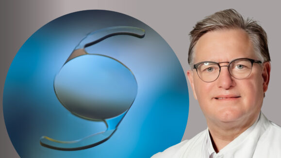 EYEDEAL_Crosslinked Polyisobutylene 03 (1)