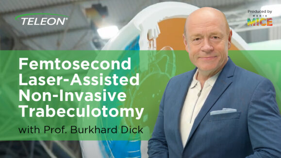 Femtosecond Laser Assisted Non Invasive Trabeculotomy with Prof. Burkhard Dick 01