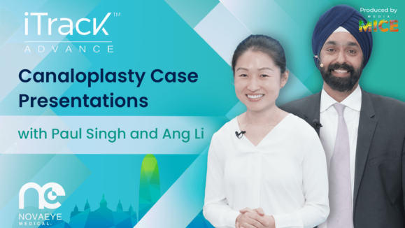 Nova Eye ESCRS Booth Talk_ (1)