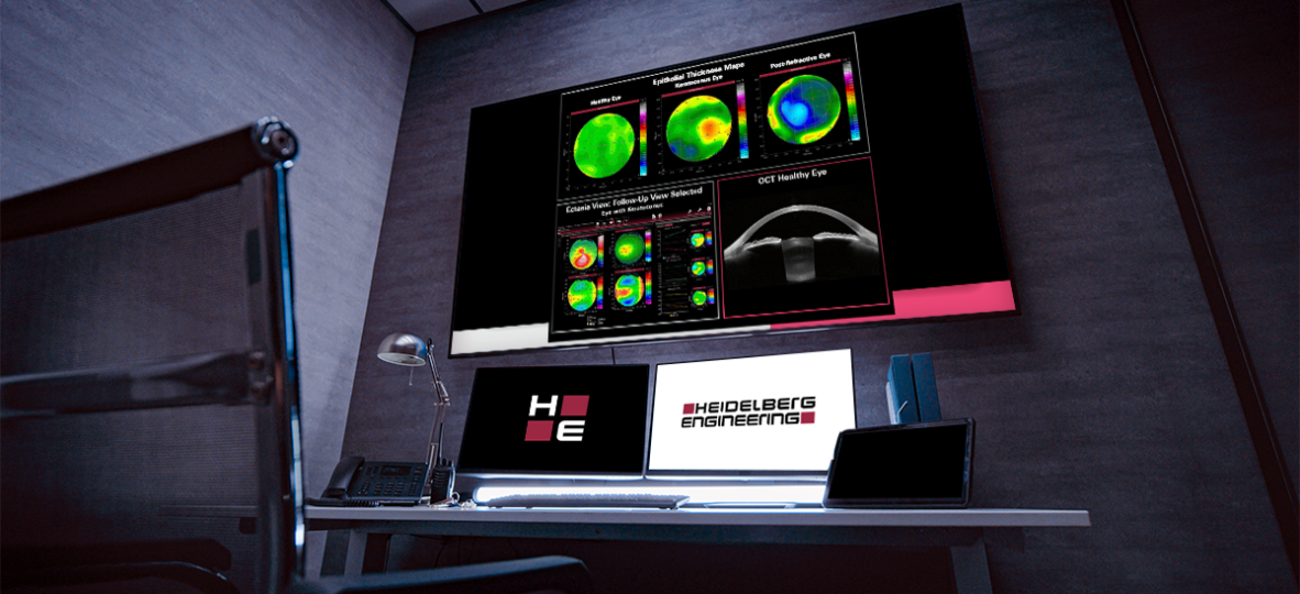 Thumbnail Article DA Clears Heidelberg’s Epithelial