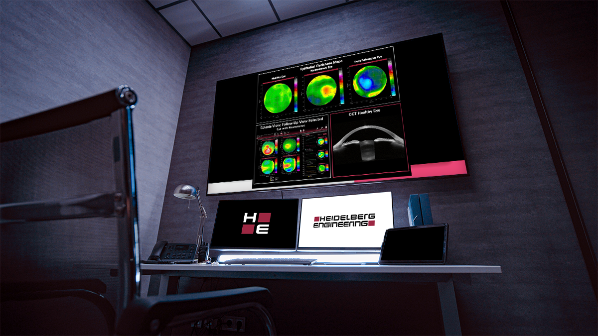 Thumbnail Article DA Clears Heidelberg’s Epithelial