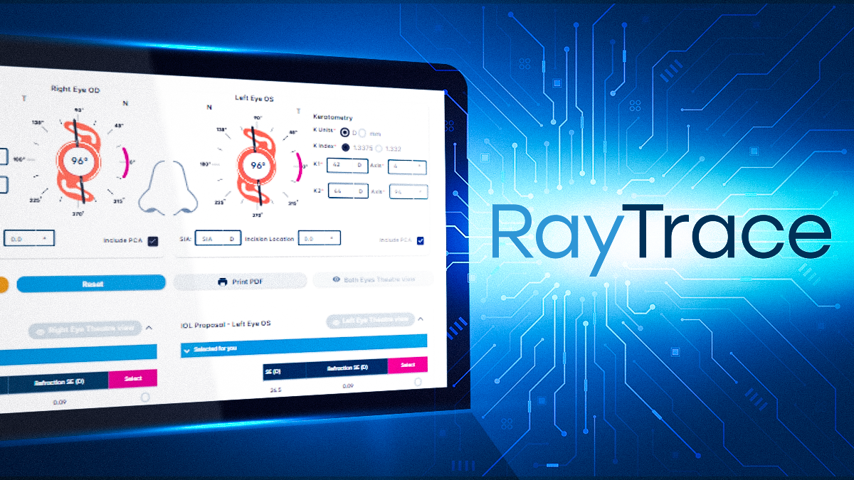 Thumbnail article _ 1200x675_Rayner Introduces RayTrace 4.0 Packed with Advanced Features