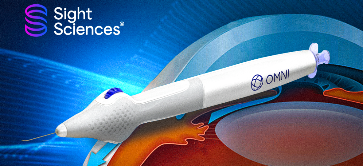 Thumbnail article _ 1200x675_Real World Data Validates OMNI®️ Surgical System’s Long Term Effectiveness for POAG