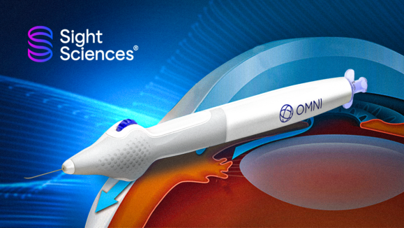Thumbnail article _ 1200x675_Real World Data Validates OMNI®️ Surgical System’s Long Term Effectiveness for POAG