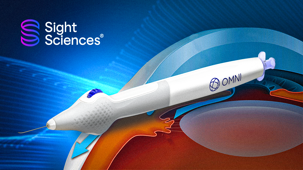 Thumbnail article _ 1200x675_Real World Data Validates OMNI®️ Surgical System’s Long Term Effectiveness for POAG